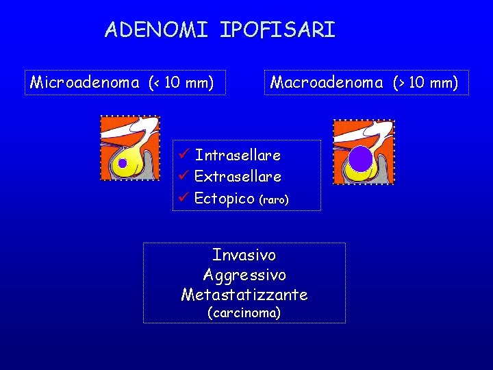 ADENOMI IPOFISARI Microadenoma (< 10 mm) Macroadenoma (> 10 mm) ü Intrasellare ü Extrasellare