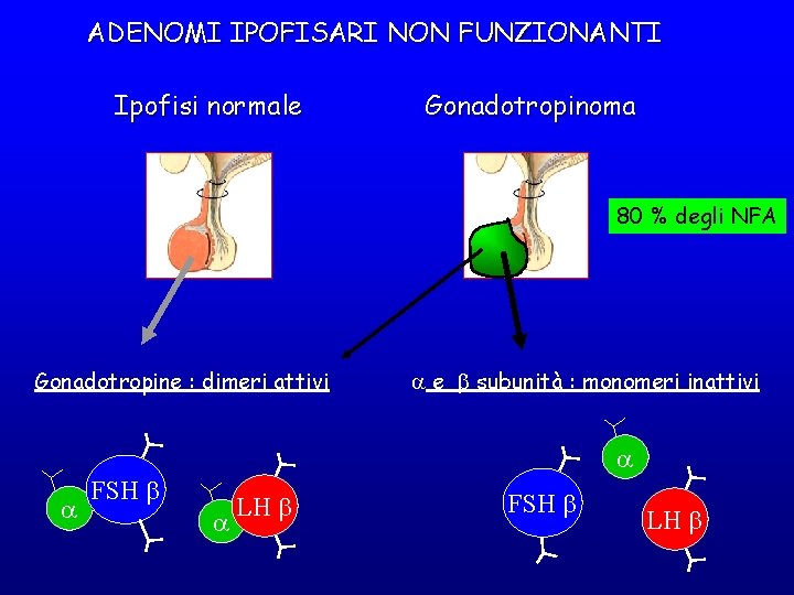 ADENOMI IPOFISARI NON FUNZIONANTI Ipofisi normale Gonadotropinoma 80 % degli NFA Gonadotropine : dimeri