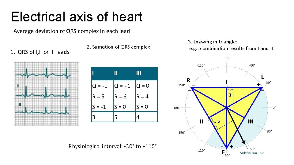 Electrical axis of heart Average deviation of QRS complex in each lead 1. QRS