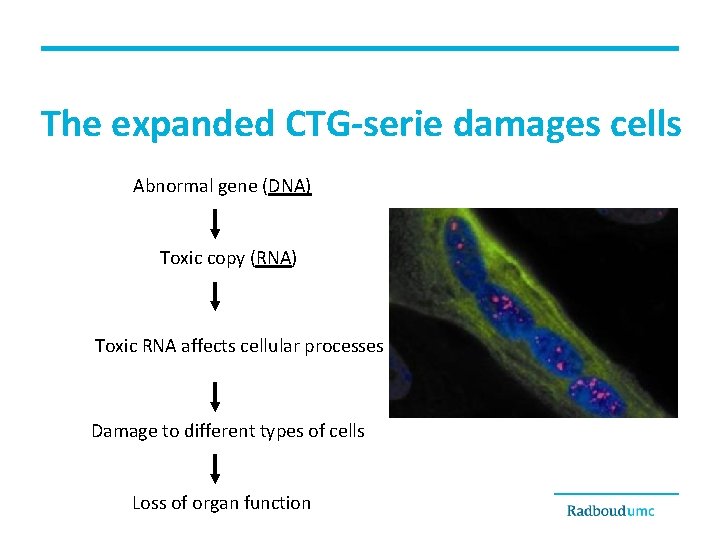 The expanded CTG-serie damages cells Abnormal gene (DNA) Toxic copy (RNA) Toxic RNA affects