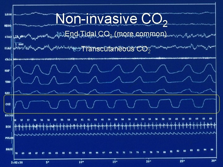 Non-invasive CO 2 End Tidal CO 2 (more common) Transcutaneous CO 2 