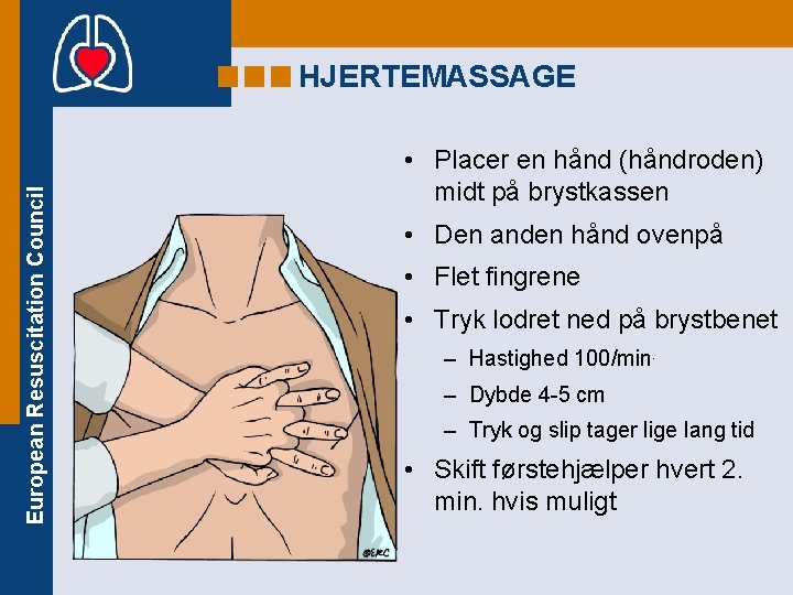 European Resuscitation Council HJERTEMASSAGE • Placer en hånd (håndroden) midt på brystkassen • Den