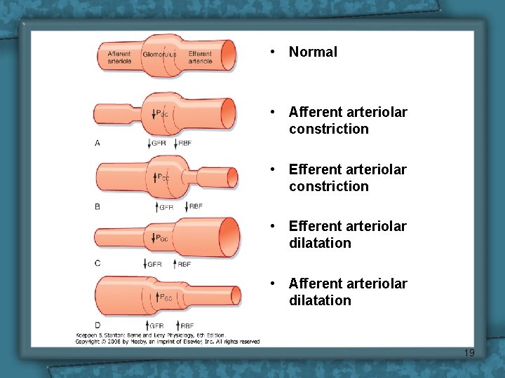 • Normal • Afferent arteriolar constriction • Efferent arteriolar dilatation • Afferent arteriolar • Normal • Afferent arteriolar constriction • Efferent arteriolar dilatation • Afferent arteriolar