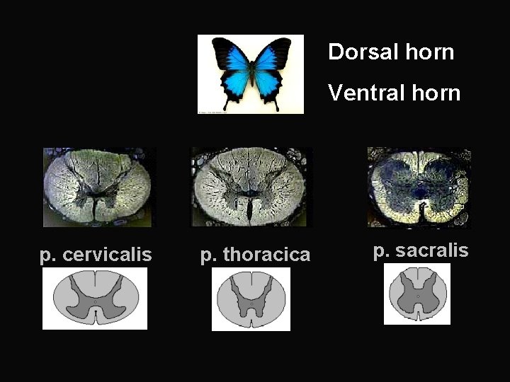 Dorsal horn Ventral horn p. cervicalis p. thoracica p. sacralis 