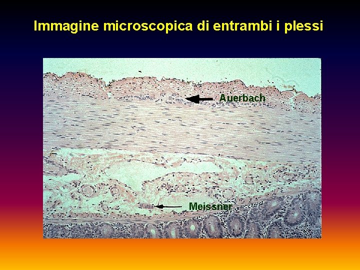 Immagine microscopica di entrambi i plessi Auerbach Meissner 