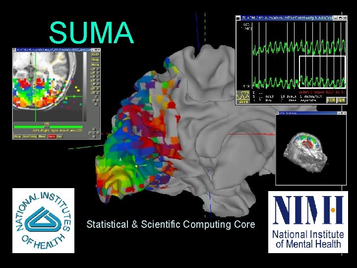 SUMA Statistical & Scientific Computing Core 1 01/21/2009 SSCC/NIMH 