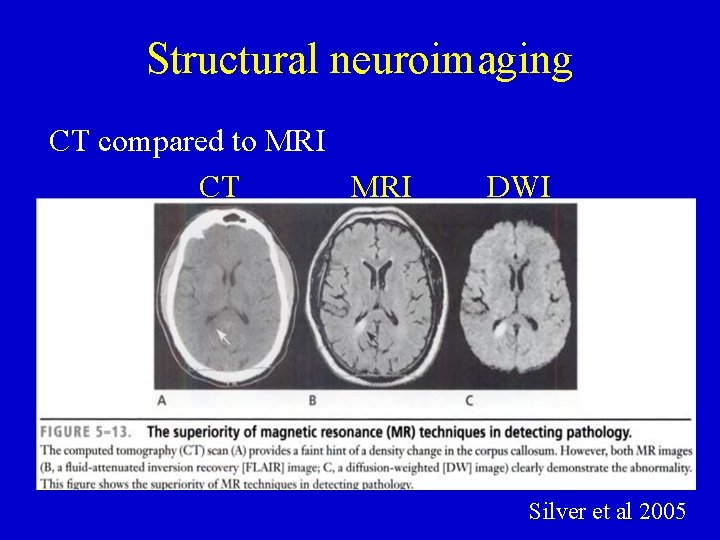 Structural neuroimaging CT compared to MRI CT MRI DWI Silver et al 2005 