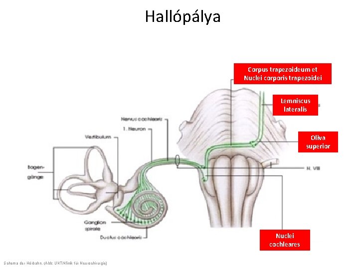 Hallópálya Corpus trapezoideum et Nuclei corporis trapezoidei Lemniscus lateralis Oliva superior Nuclei cochleares Schema