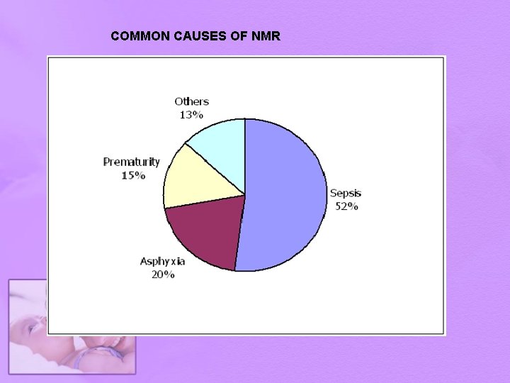 COMMON CAUSES OF NMR 