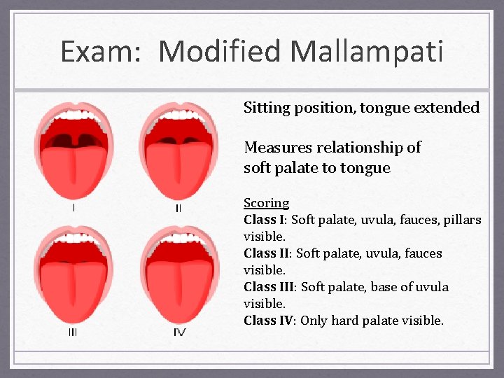 Exam: Modified Mallampati Sitting position, tongue extended Measures relationship of soft palate to tongue