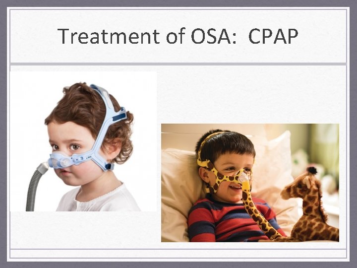 Treatment of OSA: CPAP 