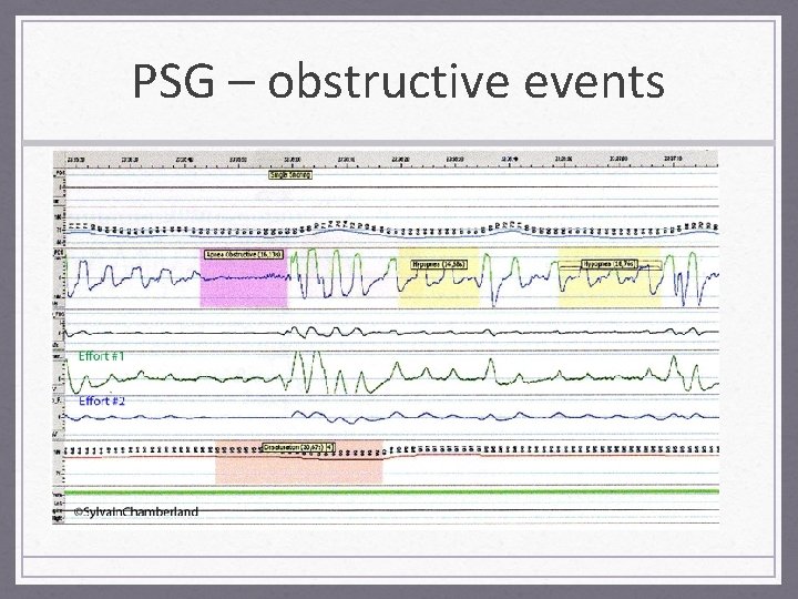 PSG – obstructive events 