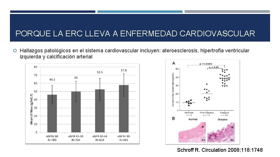PORQUE LA ERC LLEVA A ENFERMEDAD CARDIOVASCULAR Hallazgos patológicos en el sistema cardiovascular incluyen: