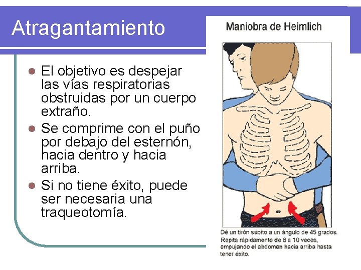 Atragantamiento El objetivo es despejar las vías respiratorias obstruidas por un cuerpo extraño. l Atragantamiento El objetivo es despejar las vías respiratorias obstruidas por un cuerpo extraño. l