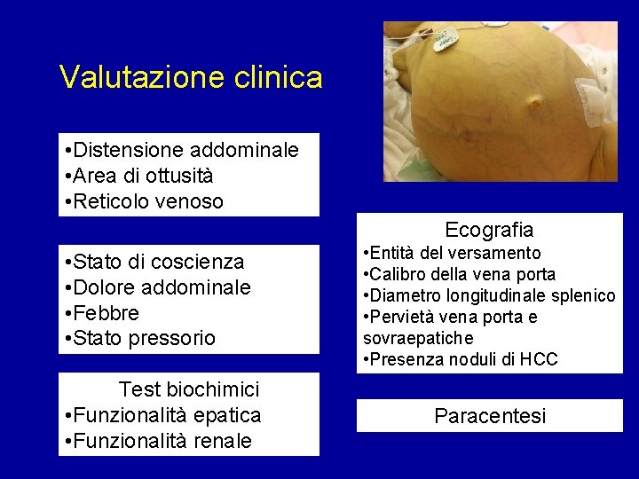 Valutazione clinica • Distensione addominale • Area di ottusità • Reticolo venoso Ecografia •