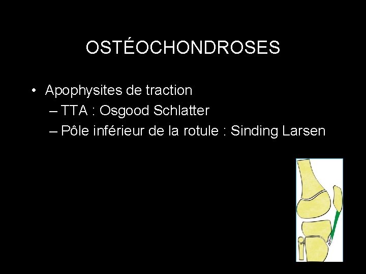 OSTÉOCHONDROSES • Apophysites de traction – TTA : Osgood Schlatter – Pôle inférieur de