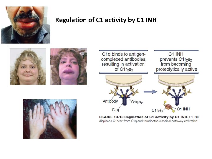 Regulation of C 1 activity by C 1 INH 