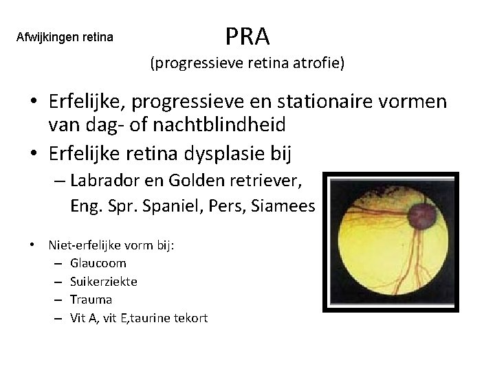 Afwijkingen retina PRA (progressieve retina atrofie) • Erfelijke, progressieve en stationaire vormen van dag-