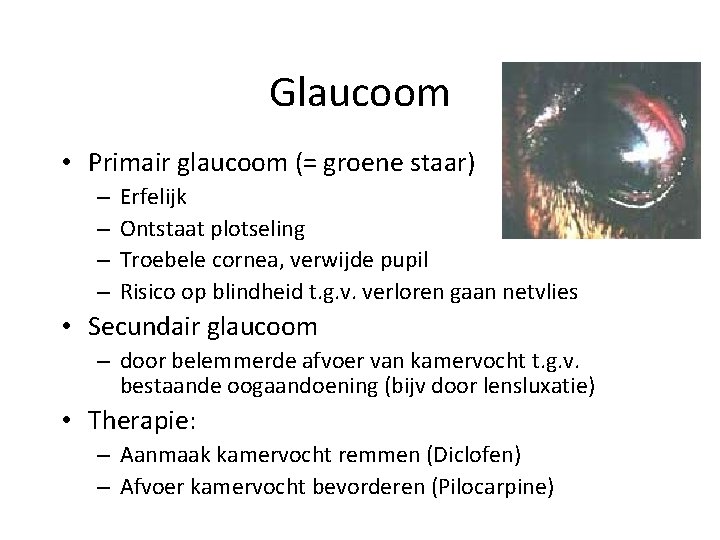 Glaucoom • Primair glaucoom (= groene staar) – – Erfelijk Ontstaat plotseling Troebele cornea,