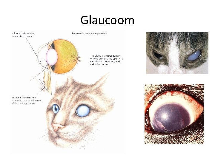 Glaucoom 