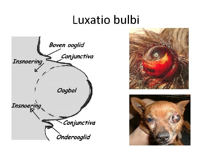 Luxatio bulbi 