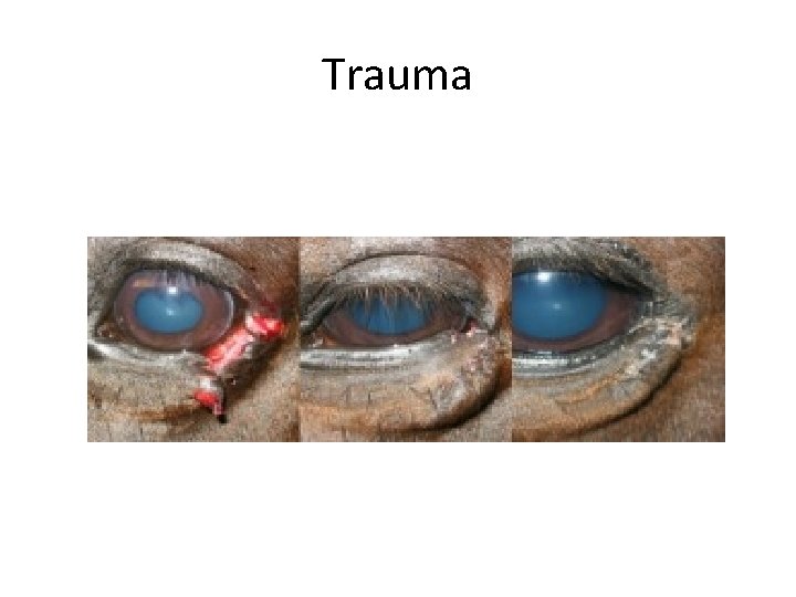 Trauma 