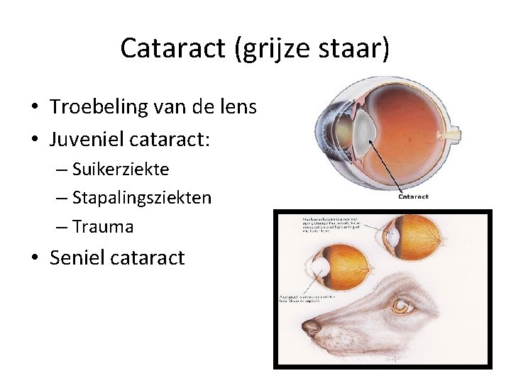 Cataract (grijze staar) • Troebeling van de lens • Juveniel cataract: – Suikerziekte –