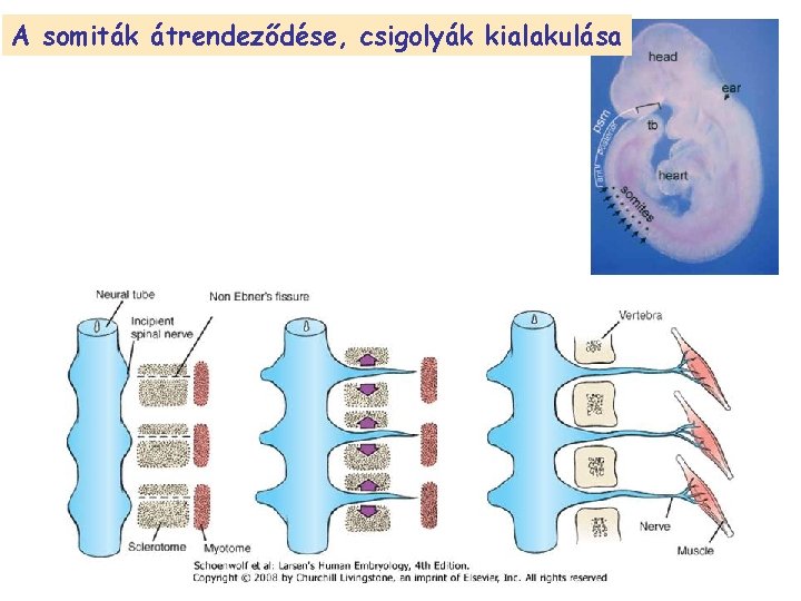 A somiták átrendeződése, csigolyák kialakulása 