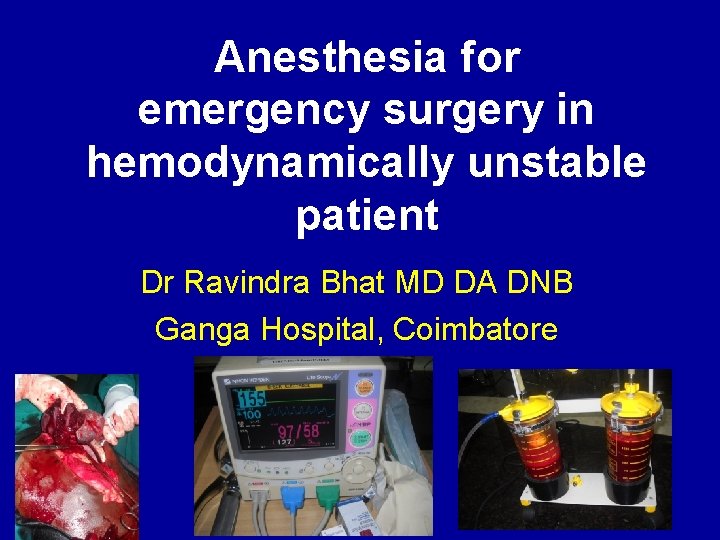 Anesthesia for emergency surgery in hemodynamically unstable patient Dr Ravindra Bhat MD DA DNB