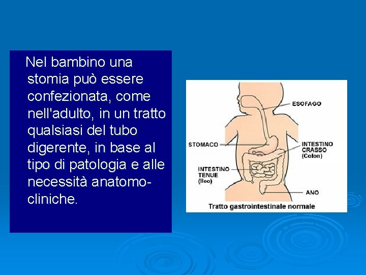 Nel bambino una stomia può essere confezionata, come nell'adulto, in un tratto qualsiasi del