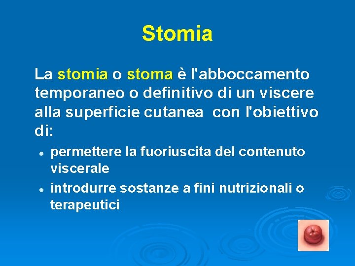 Stomia La stomia o stoma è l'abboccamento temporaneo o definitivo di un viscere alla