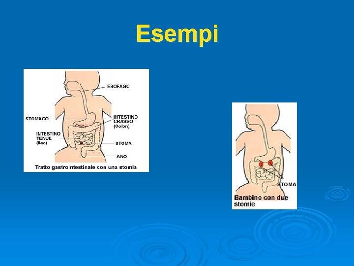 Esempi 