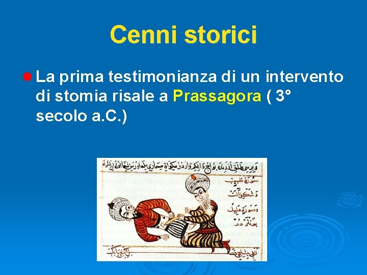 Cenni storici l La prima testimonianza di un intervento di stomia risale a Prassagora