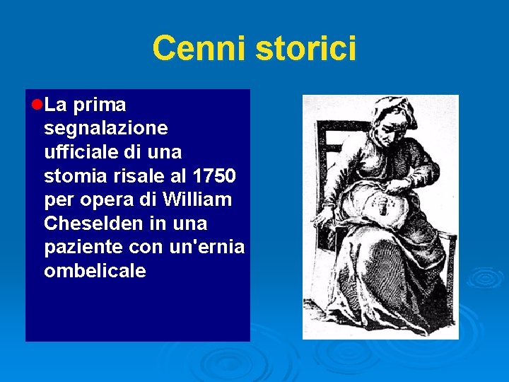 Cenni storici l. La prima segnalazione ufficiale di una stomia risale al 1750 per