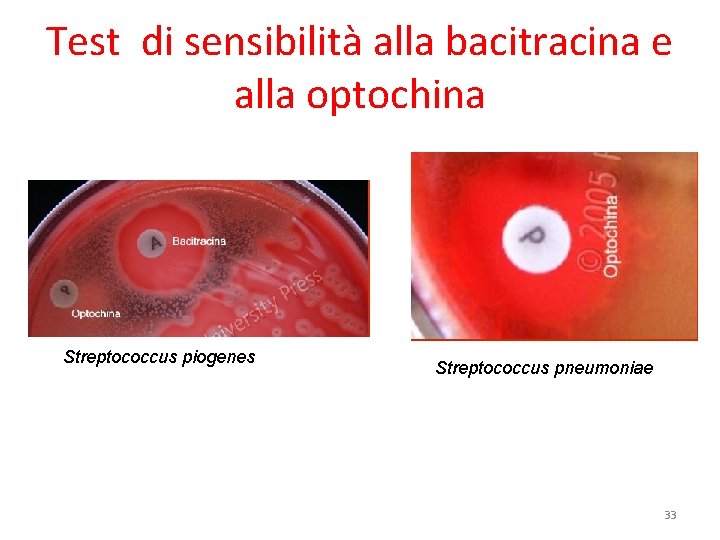 Test di sensibilità alla bacitracina e alla optochina Streptococcus piogenes Streptococcus pneumoniae 33 