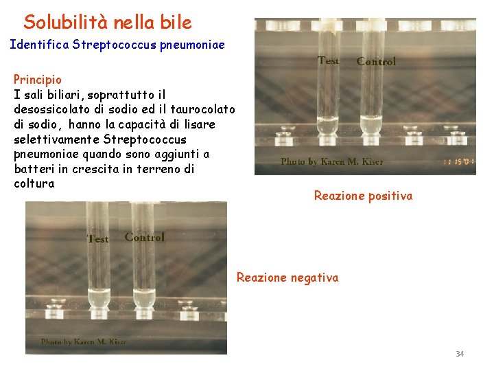 Solubilità nella bile Identifica Streptococcus pneumoniae Principio I sali biliari, soprattutto il desossicolato di