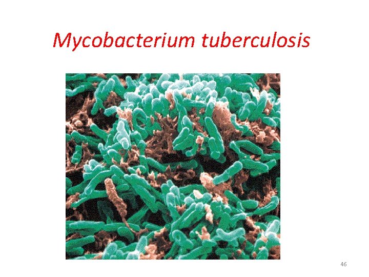 Mycobacterium tuberculosis 46 