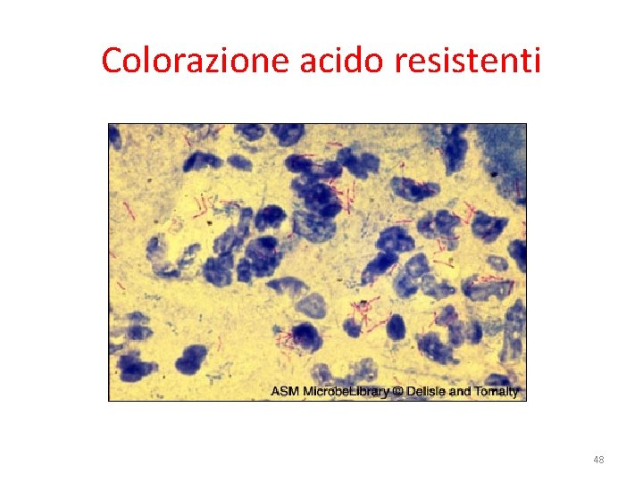 Colorazione acido resistenti 48 