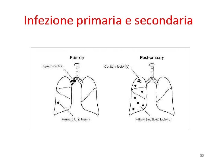 Infezione primaria e secondaria 53 
