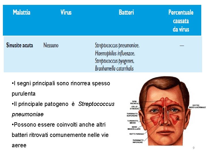  • I segni principali sono rinorrea spesso purulenta • Il principale patogeno è