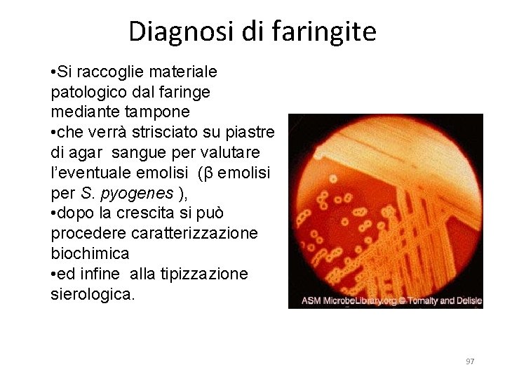 Diagnosi di faringite • Si raccoglie materiale patologico dal faringe mediante tampone • che
