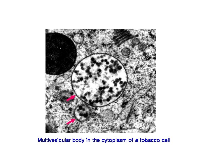 Multivesicular body in the cytoplasm of a tobacco cell 