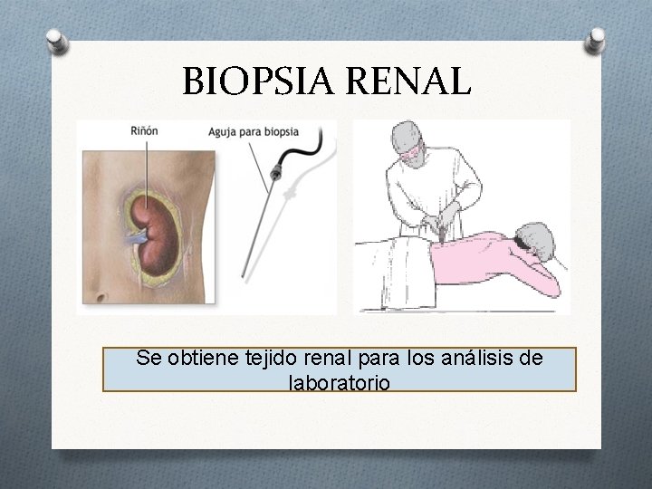 Biopsia Riñon FUNCION VALORACION Y MEDIDAS TERAPEUTICAS DEL SISTEMA URINARIO