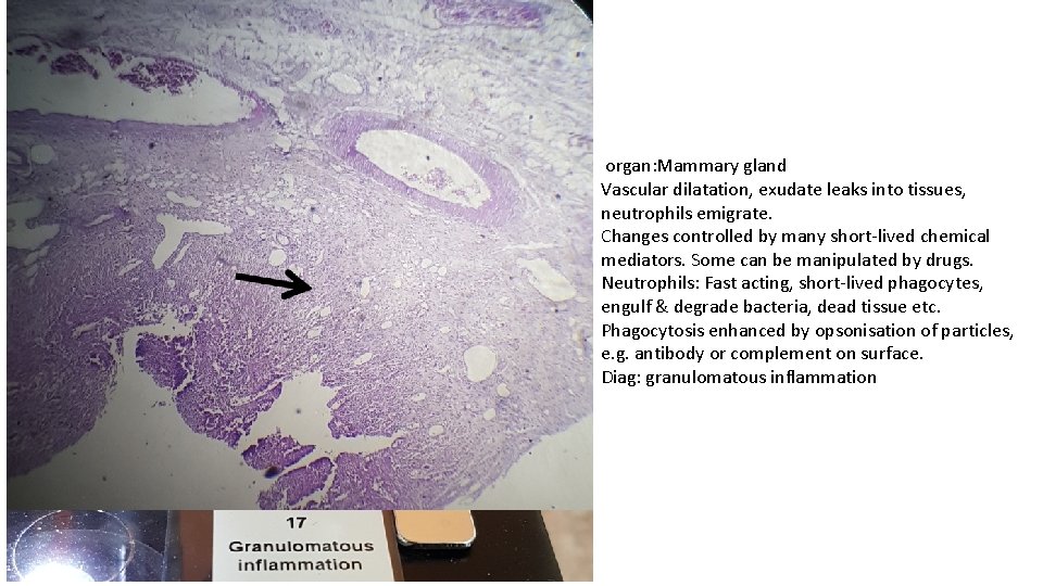 organ: Mammary gland Vascular dilatation, exudate leaks into tissues, neutrophils emigrate. Changes controlled by