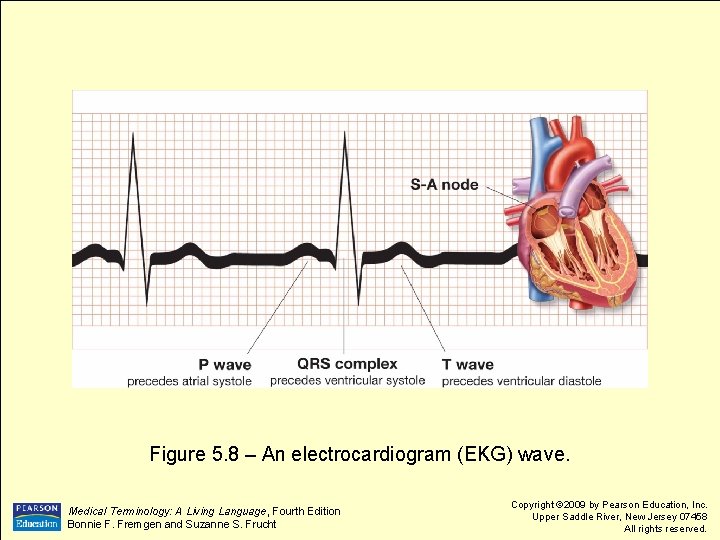 Figure 5. 8 – An electrocardiogram (EKG) wave. Medical Terminology: A Living Language, Fourth