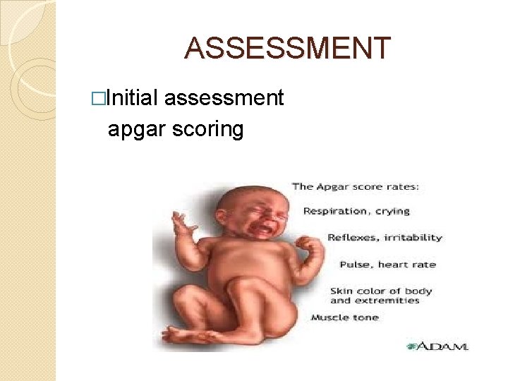 HIGH RISK NEWBORN GOALS CONCEPTS PRINICPLES ASSESSMENT NURSING