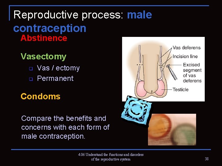 Reproductive process: male contraception Abstinence Vasectomy q q Vas / ectomy Permanent Condoms Compare
