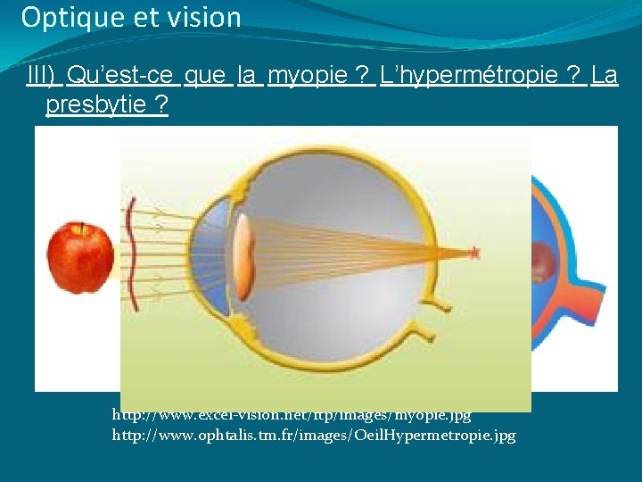 Optique et vision III) Qu’est-ce que la myopie ? L’hypermétropie ? La presbytie ?