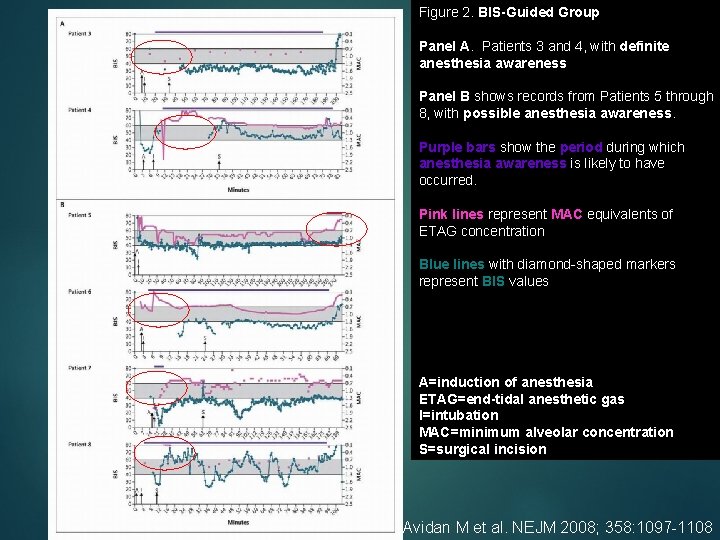 Figure 2. BIS-Guided Group Panel A. Patients 3 and 4, with definite anesthesia awareness