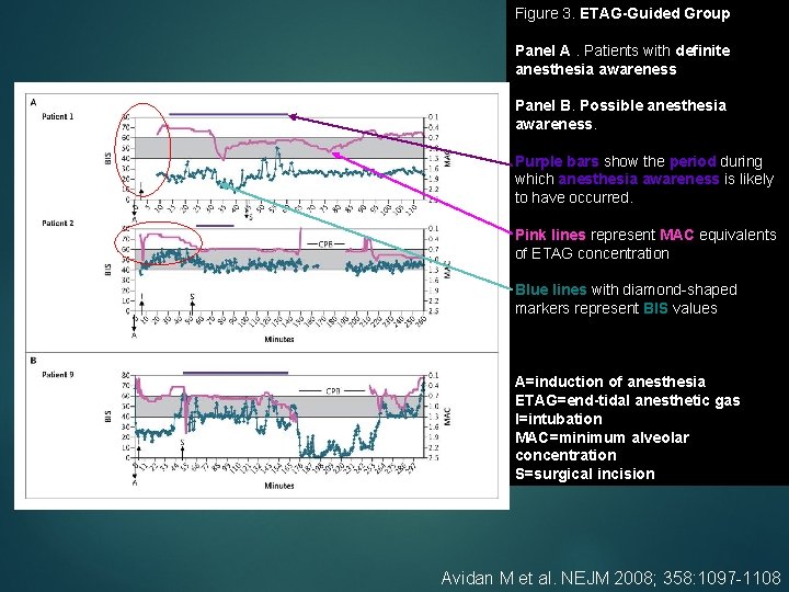 Figure 3. ETAG-Guided Group Panel A. Patients with definite anesthesia awareness Panel B. Possible